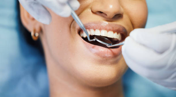 Best Emergency Broken Tooth Repair in Eagan, MN
